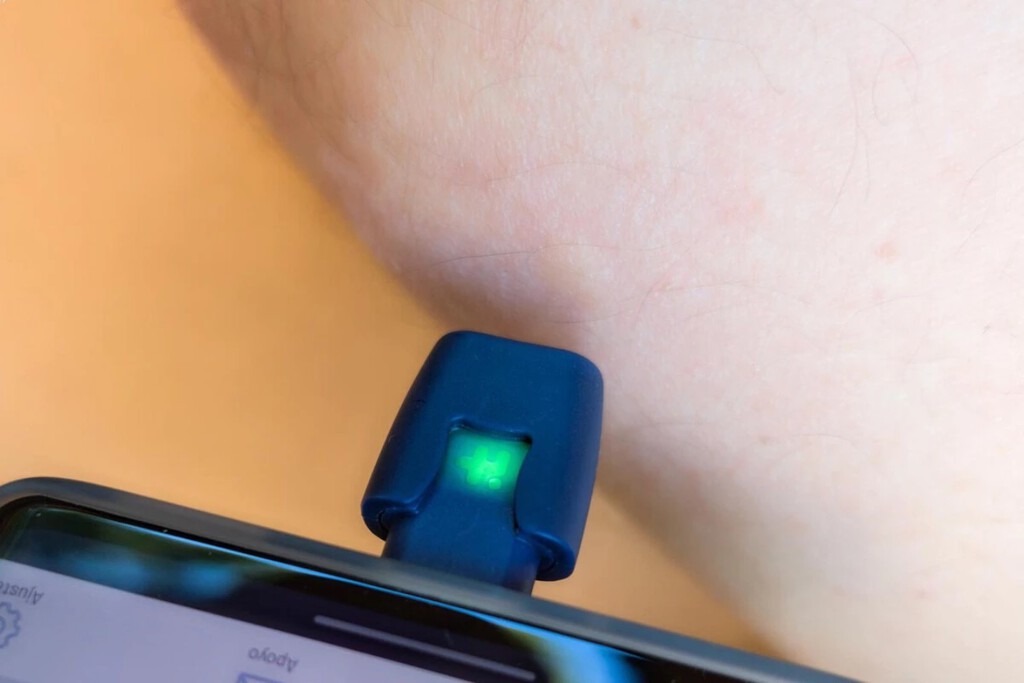 Accesorio USB-C alivia picaduras de mosquitos con calor