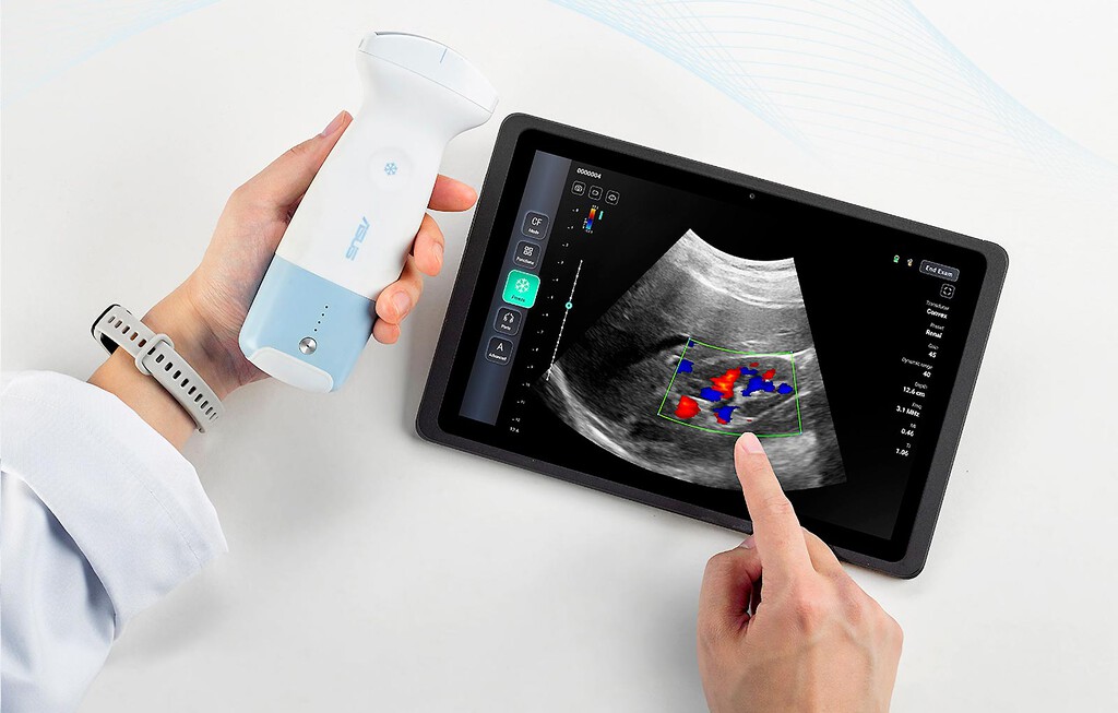 Asus lanza escáner de ecografías portátil para móviles